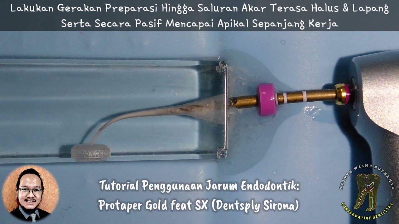 Tutorial Jarum Endodontik: ProTaper Gold feat SX (Dentsply Sirona)