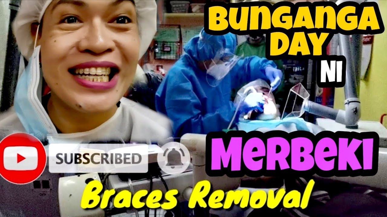 Removing my Dental Braces Day #pinoyvlogs #pinoyvlogs #dentalbraces #brackets #dentalhealth #merbeki