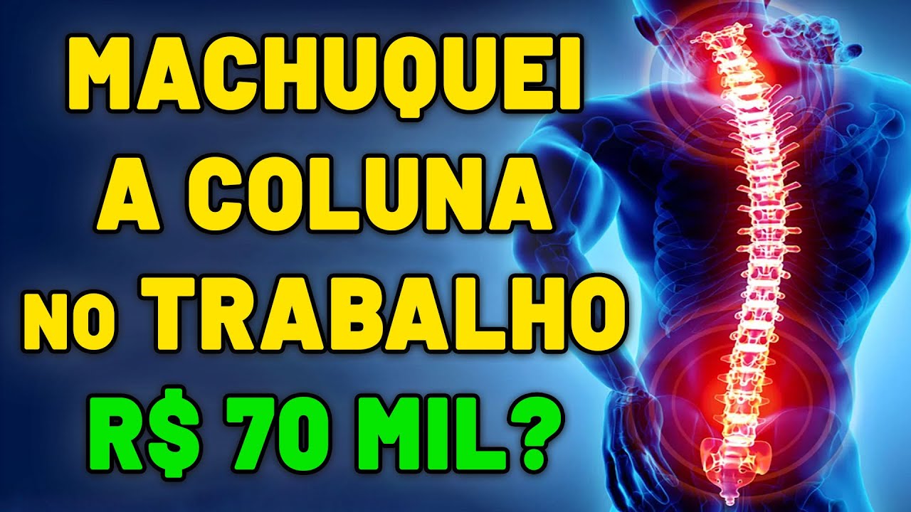 MACHUQUEI A COLUNA NO TRABALHO QUAIS SÃO MEUS DIREITOS? PODE SER DEMITIDO? INDENIZAÇÃO EM DINHEIRO