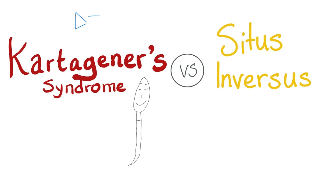 Kartagener's Syndrome vs. Situs Inversus Totalis - Immotile Cilia Syndrome - Dynein Defect - Biochem