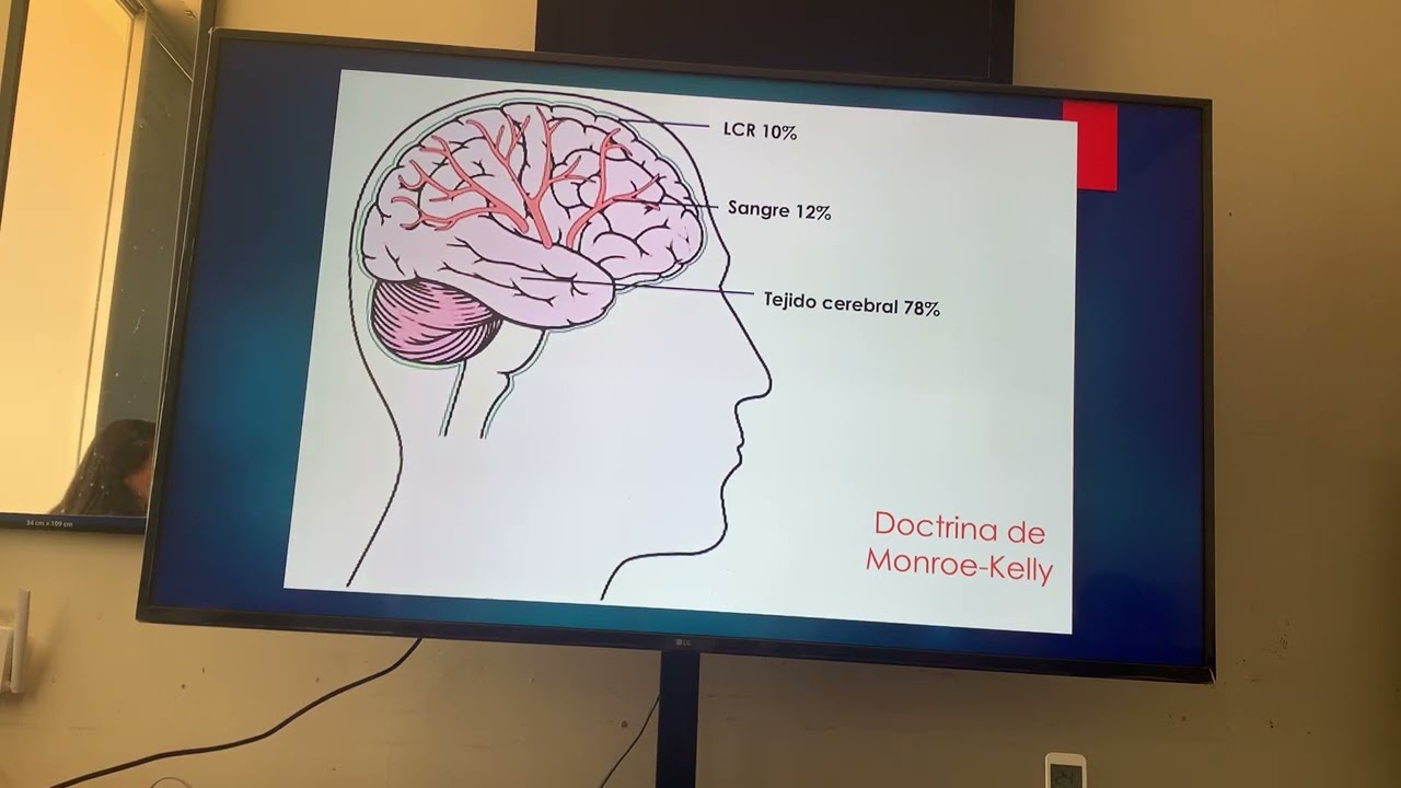 Neuromonitoreo