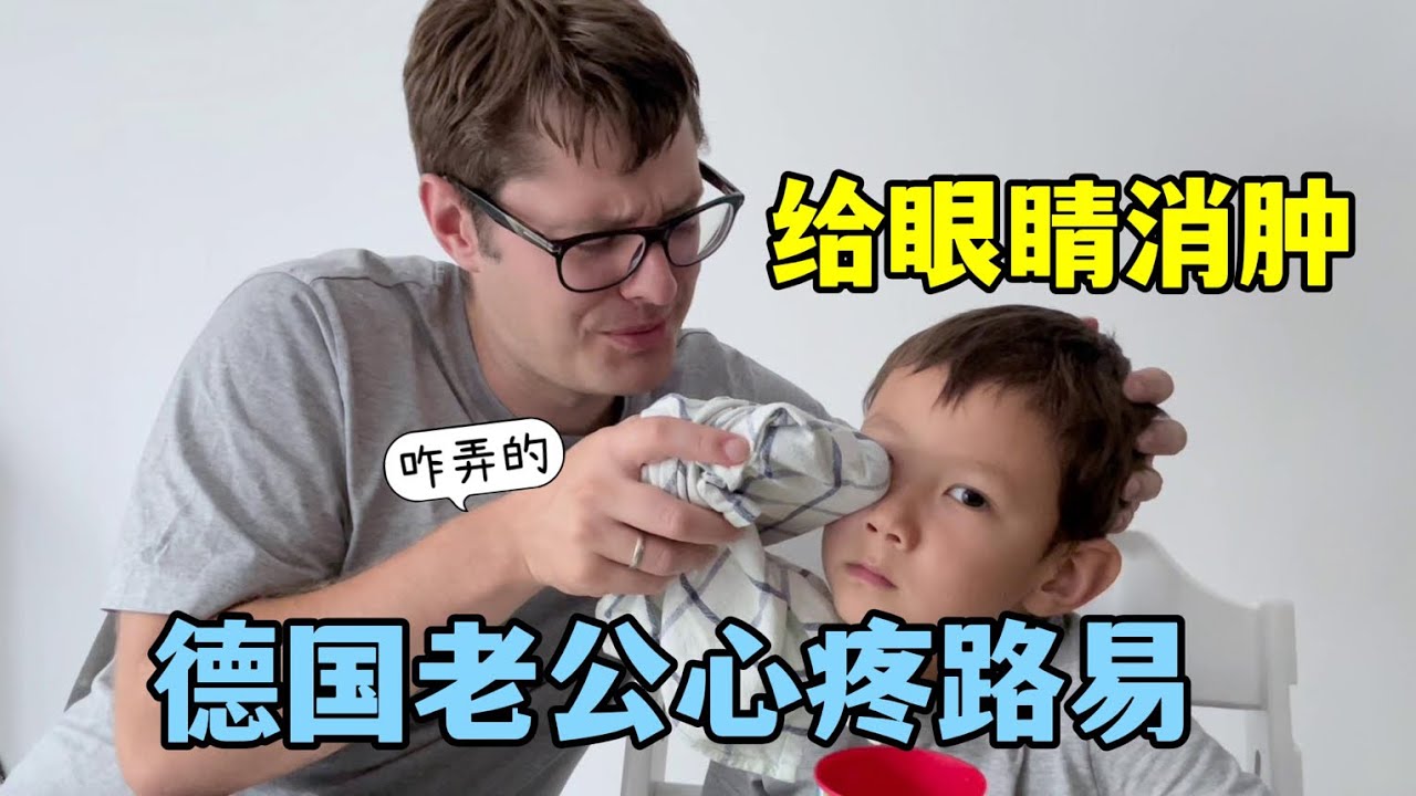 德國老公去幼兒園接路易，結果兒子臉腫的想被打一樣，啥情況？