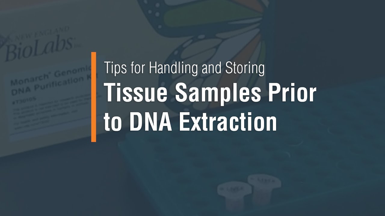 Tips for Handling and Storing Tissue Samples Prior to DNA Extraction