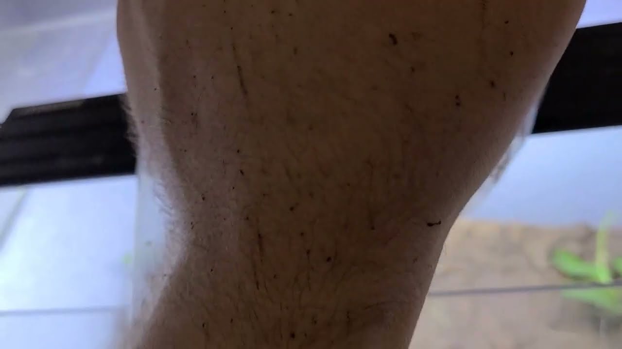 Liberating Odorous House Ants Tapinoma sessile