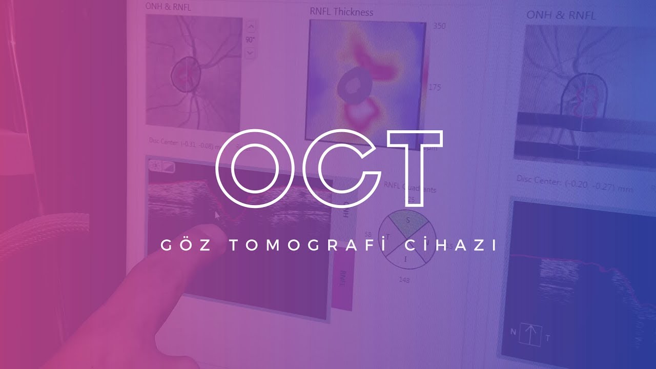 OCT Göz Tomografi Cihazı - Opr. Dr. Celal Yeter