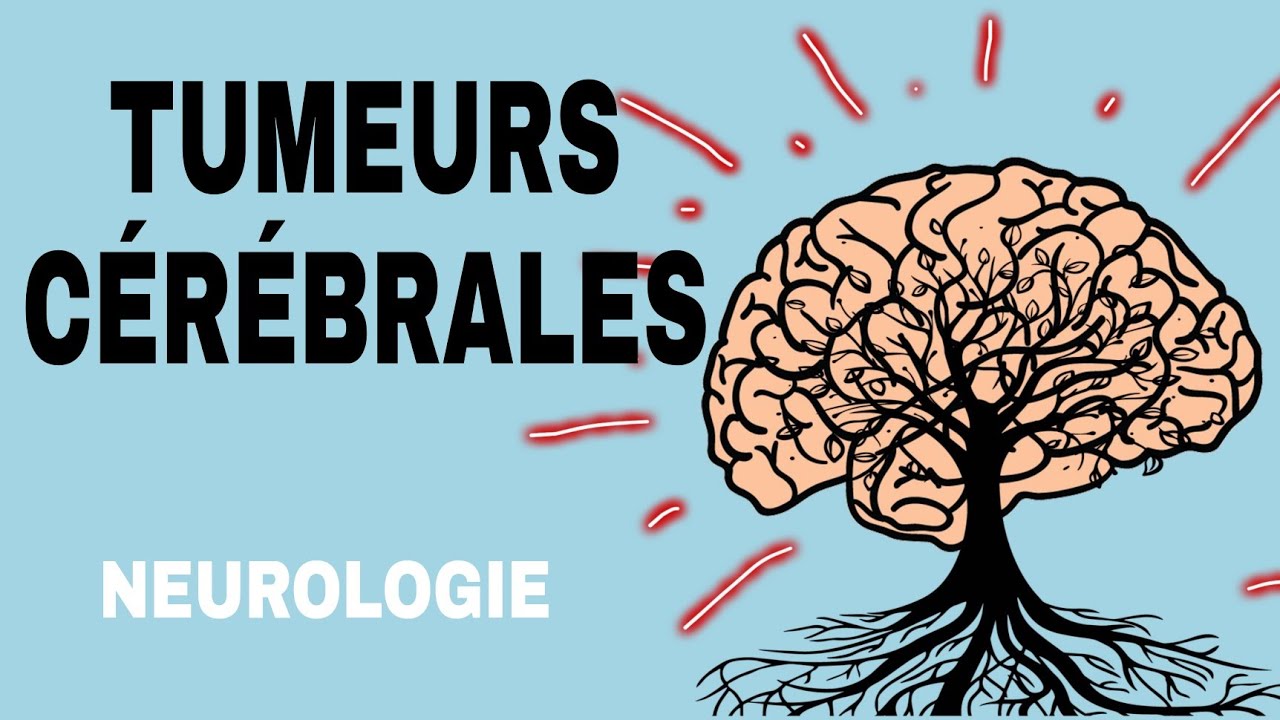 NEUROLOGIE : TUMEURS CÉRÉBRALES 🌟