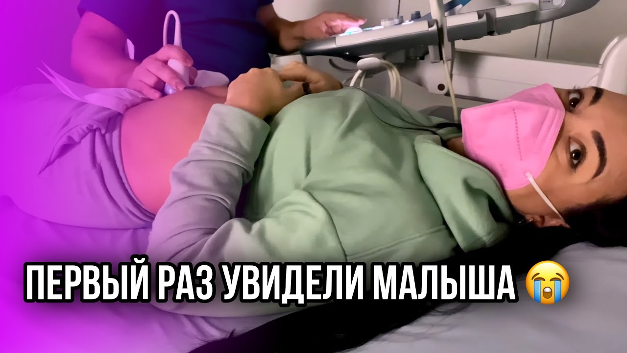 Скрининг Первый раз увидели ребенка. Но не получилось...