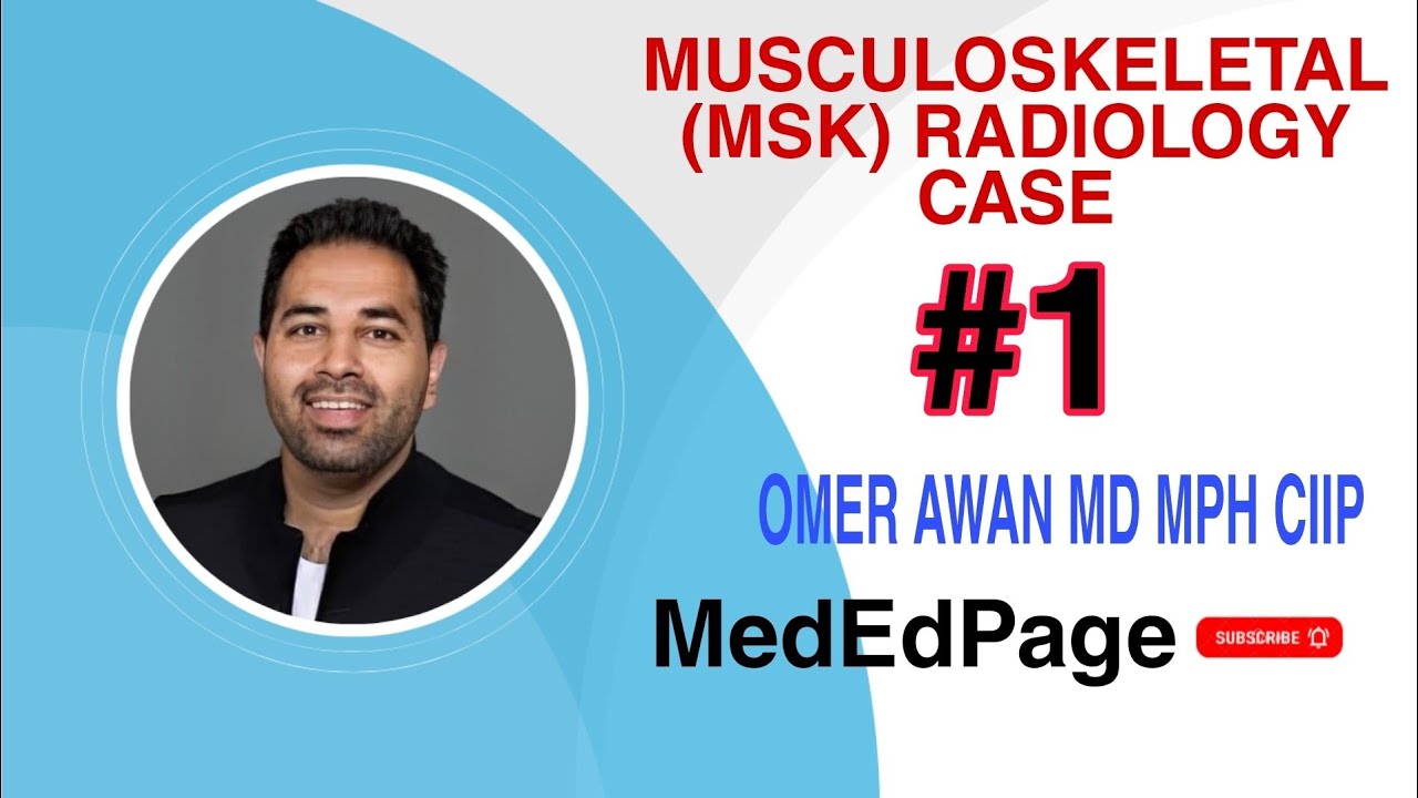 Musculoskeletal (MSK) Radiology Case #1