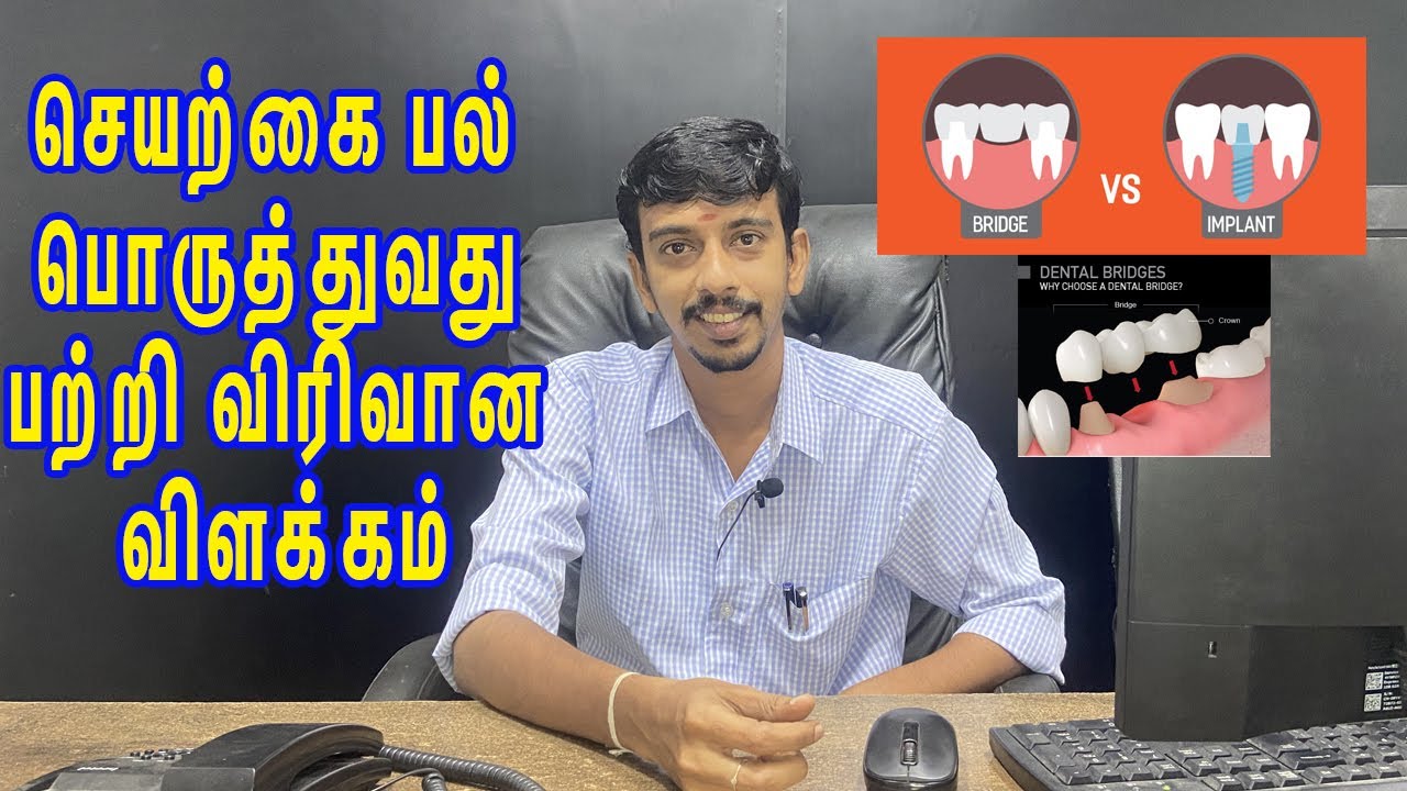 செயற்கை பல் பொருத்துவது பற்றி விரிவான விளக்கம் WHAT IS IMPLANT & HOW IT SUPPORTS IN DENTAL TREATMENT