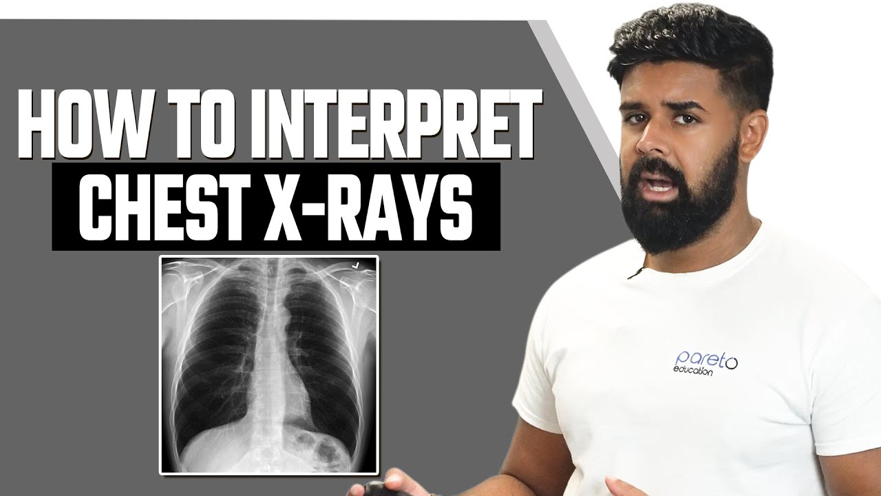 Mastering Chest X-Ray Interpretation: A Step-by-Step Guide | Pareto Education