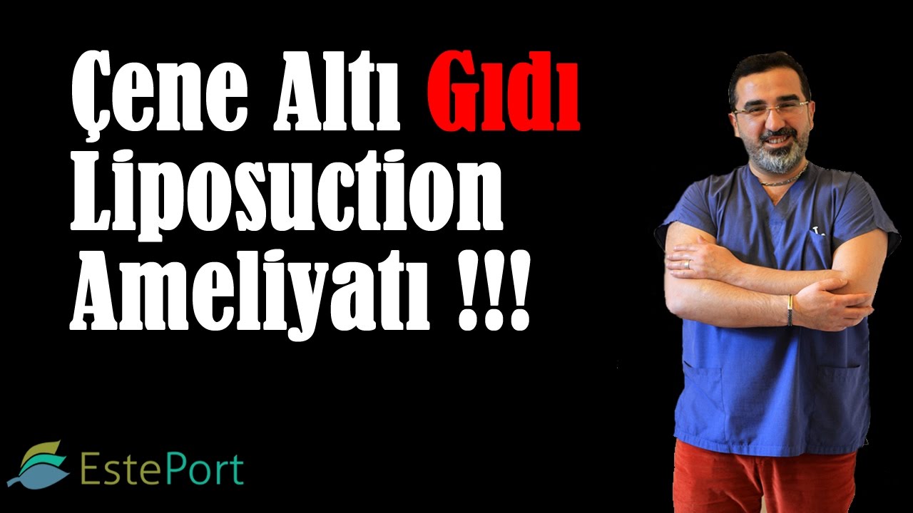 Çene Altı Gıdı Liposuction Ameliyatı