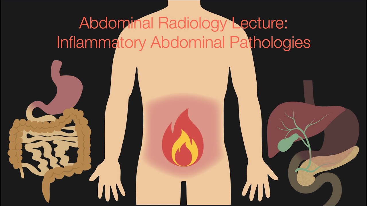 Abdominal Radiology Lecture: Inflammatory Pathologies