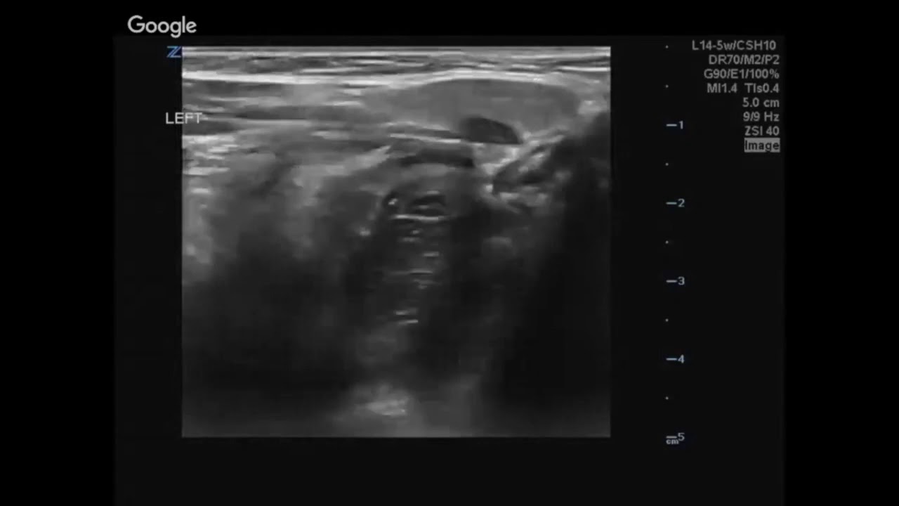 Cysts (2/5)