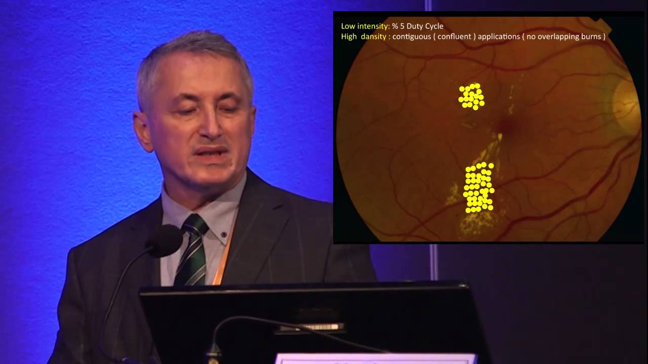 Euretina/ESCRS 2015 - Treatment of Chronic Central Serous Chorioretinopathy