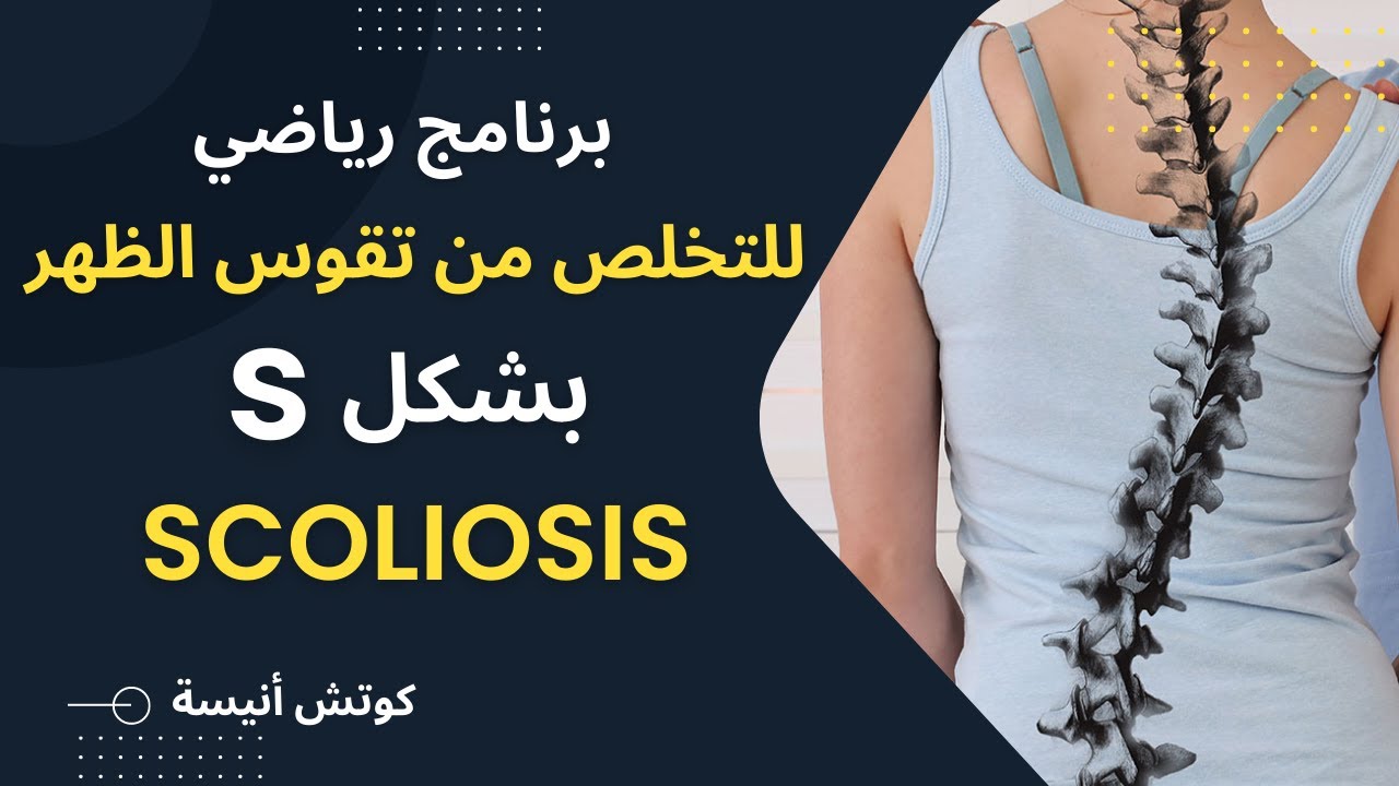 تخلص من تقوس الظهر بشكل S :Scoliosis للأبد مع كوتش أنيسة💗