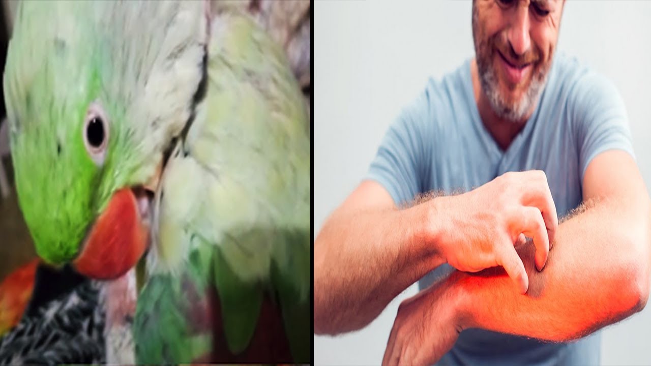 Khaarish Ka Ilaaj | Birds ko Khaarish Kiun hoti he? | Birds Itching Problem | Lodhi Birds