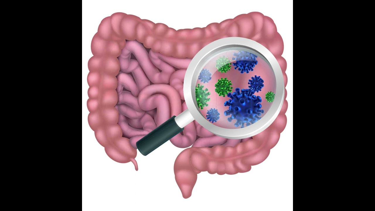 S2 E12 Natural Remedies That Improve Gut Health with Kylie Ivanir MS, RD.