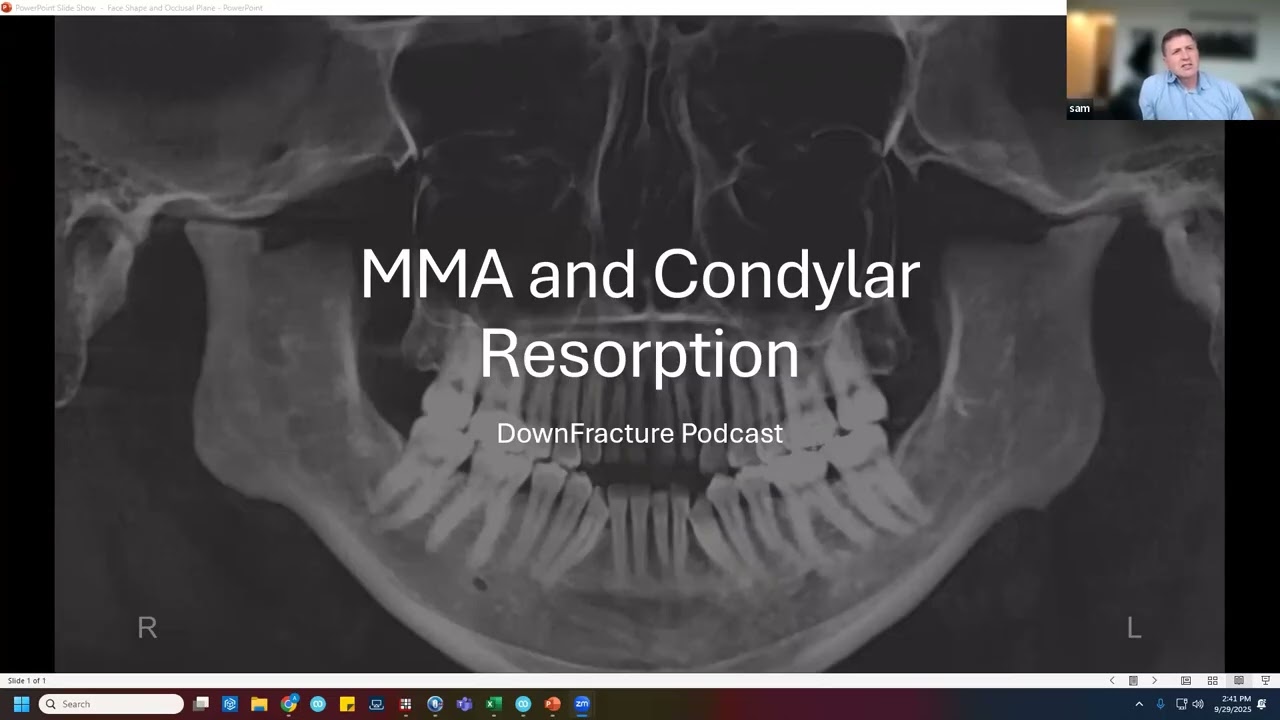 Condylar Resorption & Maxillomandibular Advancement