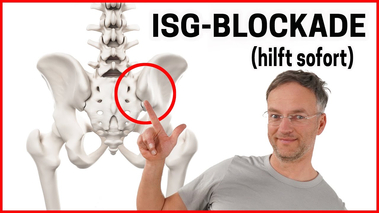 ISG Blockade SELBST l&ouml;sen - 2 &Uuml;bungen (kennt keiner!)