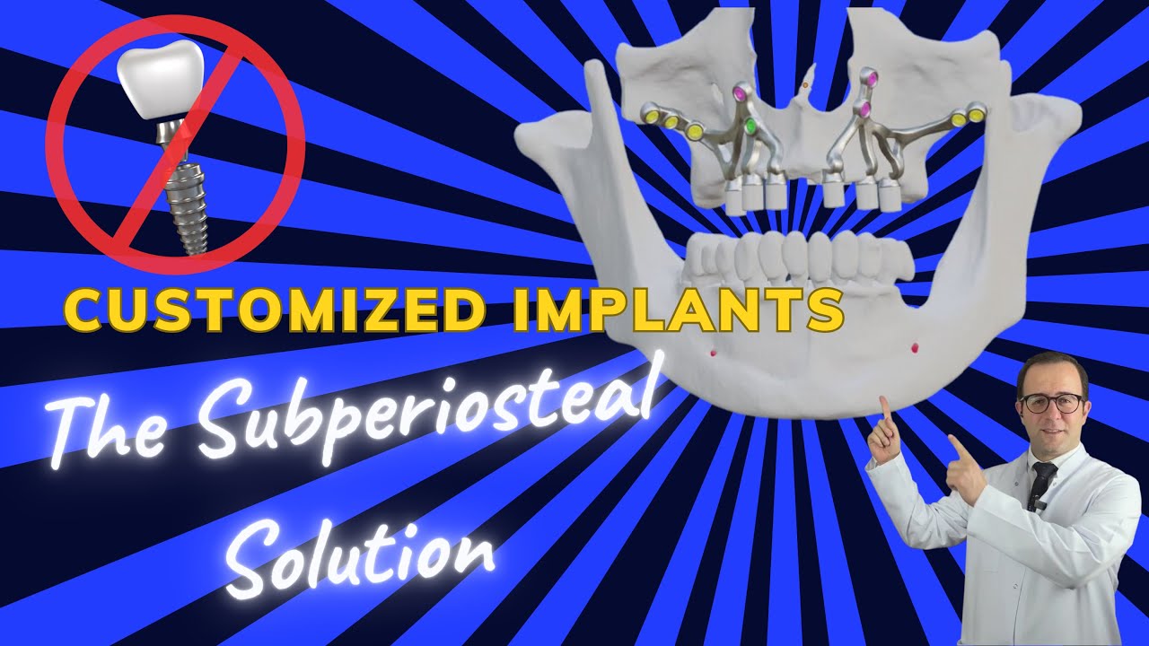 Custom Dental Implants: The Subperiosteal Solution  //  NO BONE GRAFTS!