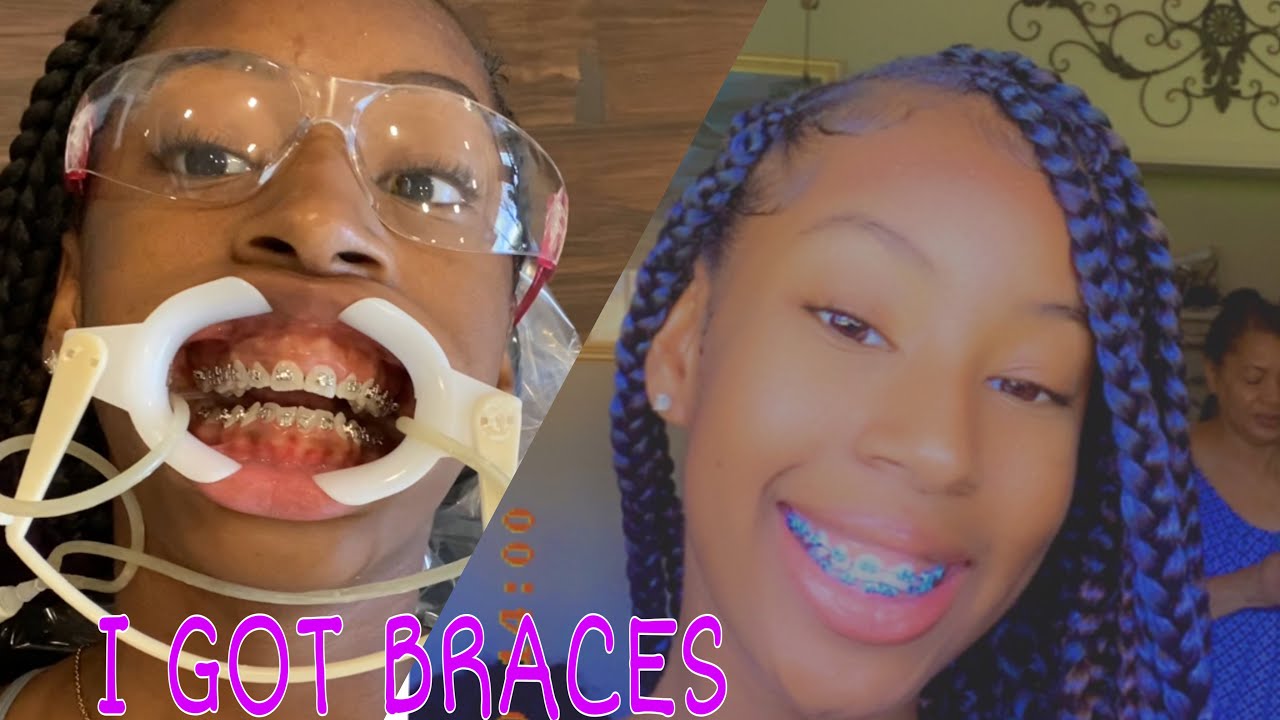 COME WITH ME TO GET BRACES! | BRACES VLOG