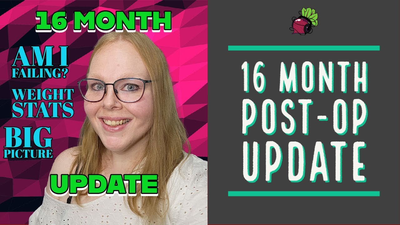 16 Month Post-Op Update // Bariatric Surgery in Mexico | My Gastric Bypass Journey