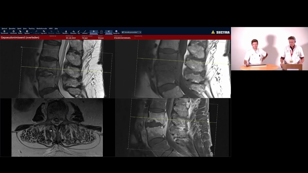 Polikliniek radiologie #6 MRI LWK