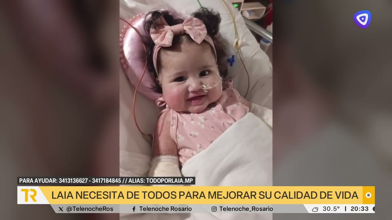 La familia de una beba de 8 meses a la que le amputaron las manos y un pie necesita donaciones