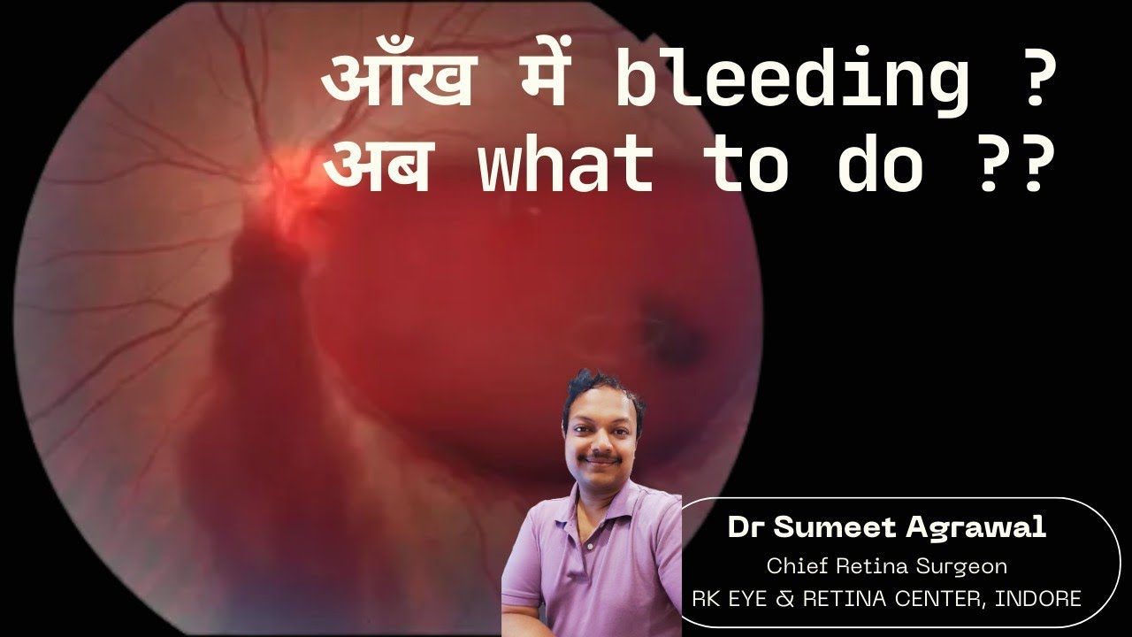 Retina में Bleeding ! क्या करे जब हो जाए Vitreous Hemorrhage ?