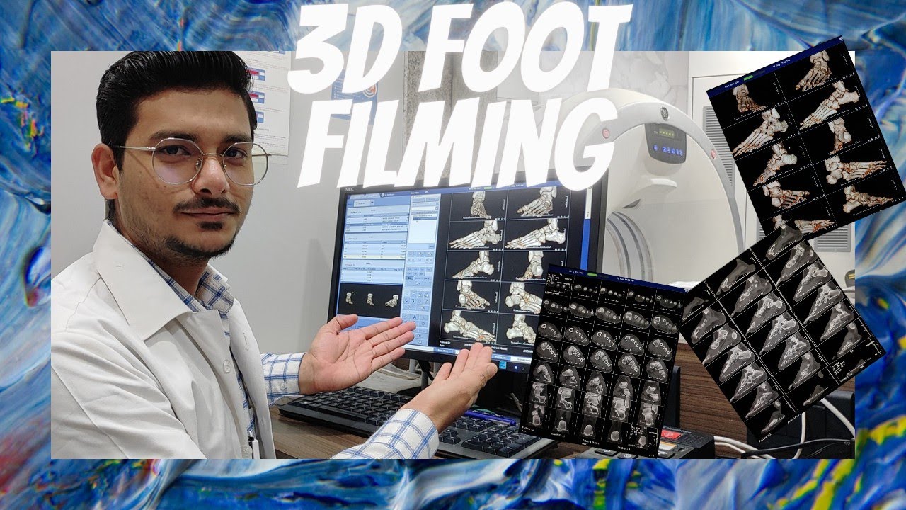 CT SCAN 3D FOOT FILMING PROCESS & TECHNIQUES ON GE MACHINE #radiologytechnologist #ctscan