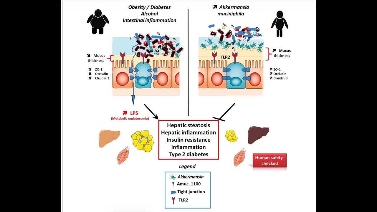 Pasteurized Akermansia and Metabolic Health