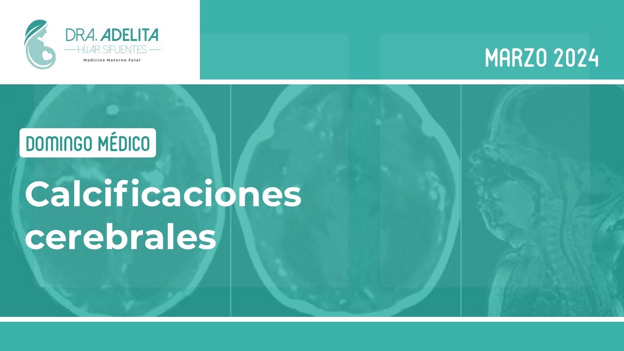 Calcificaciones cerebrales