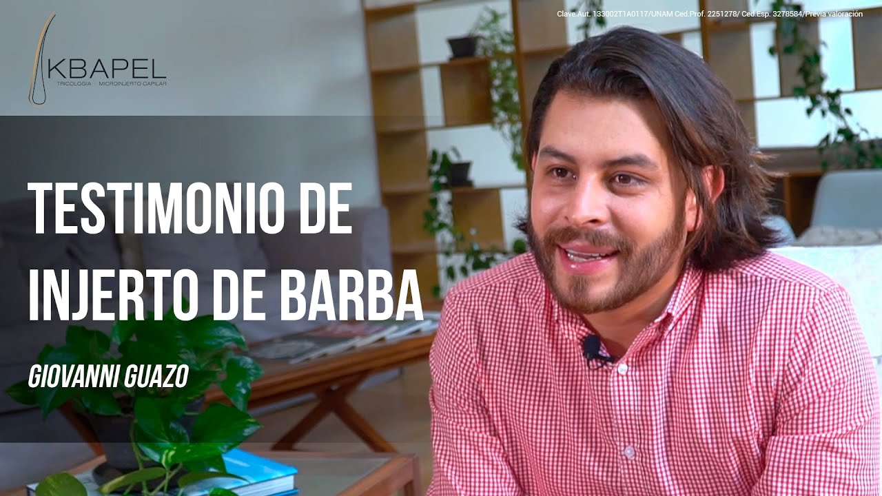 INJERTO DE BARBA CON TÉCNICA F.U.E.-GIOVANNI