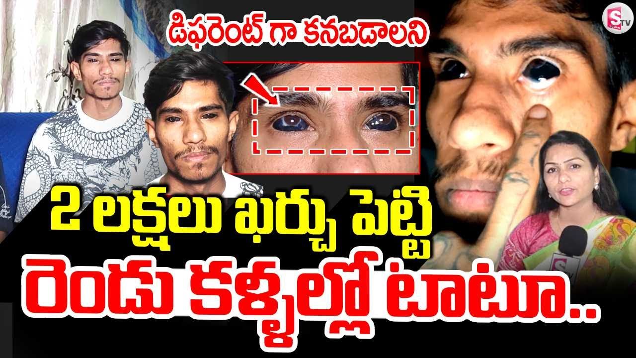 Vizag Eyeball Tattoo | Eyeball Tattoo | డిఫరెంట్ గా కనబడాలి | Vizag News Updates #eyeballtattoo