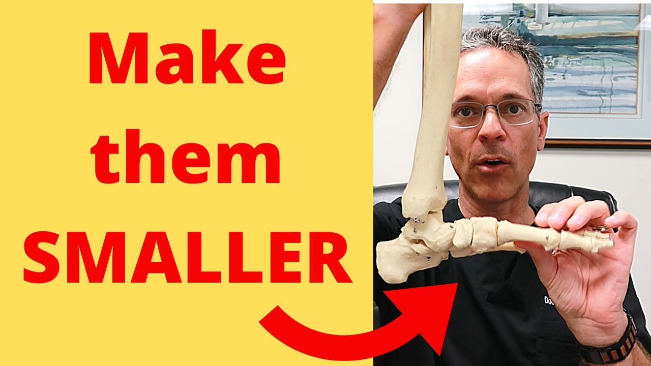 How to Make your Foot Size SMALLER👈💥