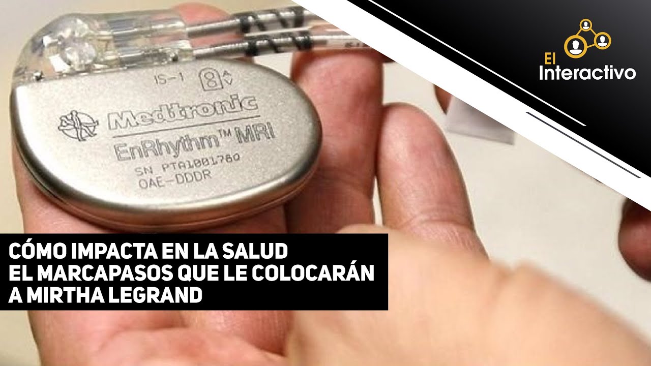 La colocación de marcapasos en personas mayores: mitos y realidades