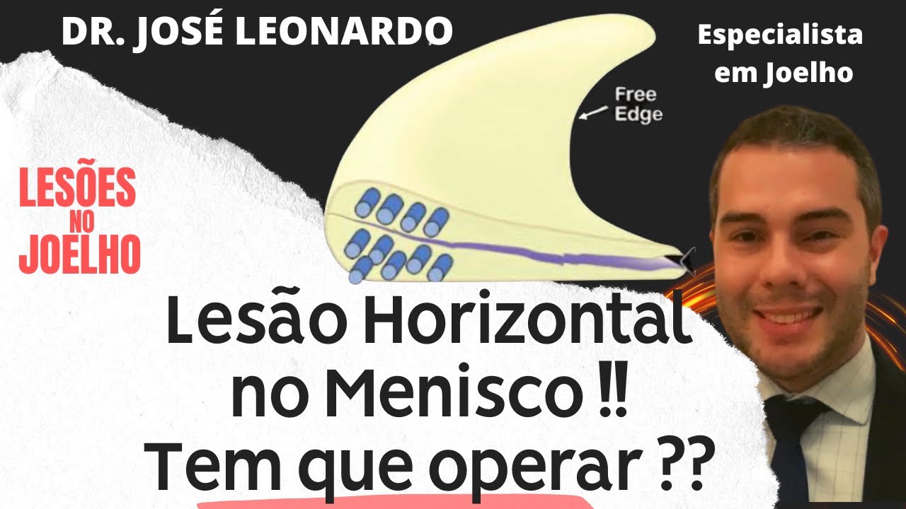 Lesão Horizontal no Menisco ! Tem que operar ??