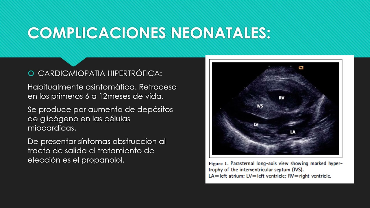 HIJO DE MADRE DIABÉTICA Asistente Dra Tamara Herrera Neonatología CHPR