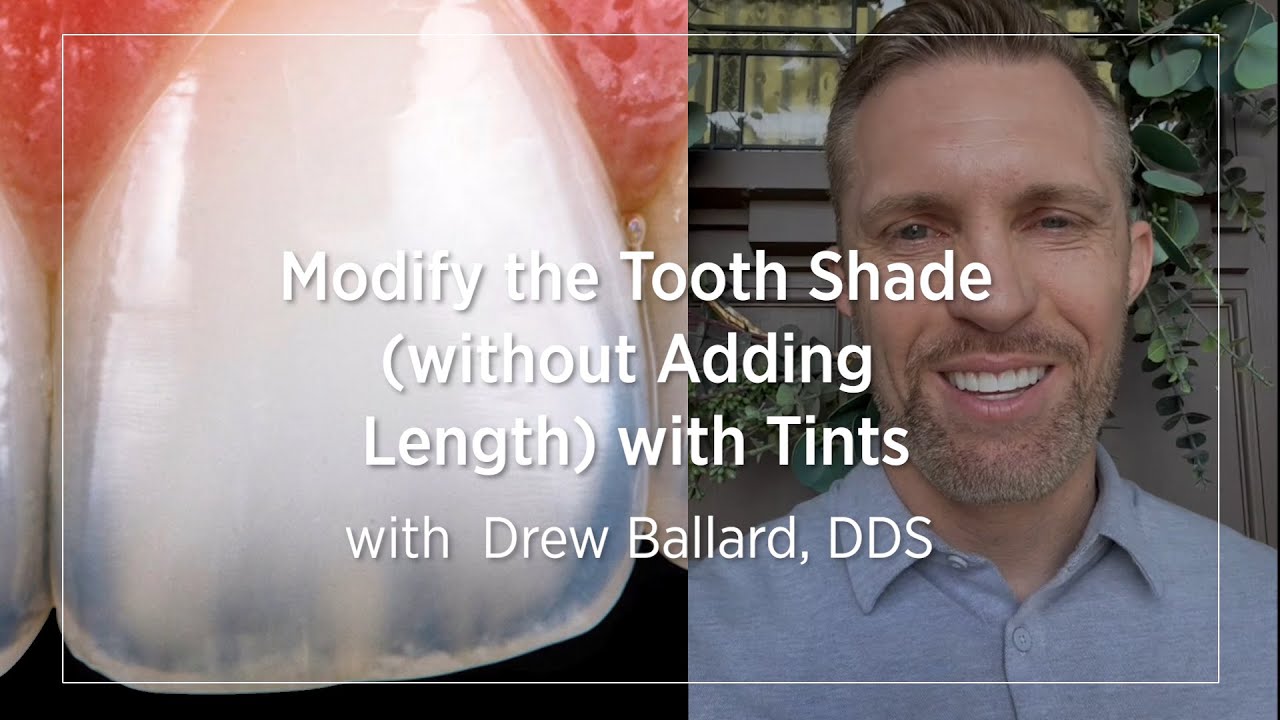 Modify the Tooth Shade (without Adding Length) with Tints