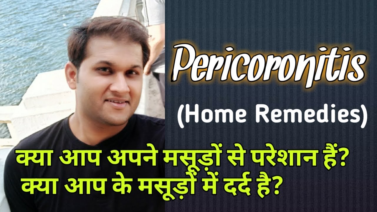 Pericoronitis (Home Remedies) | What are the home remedies for pericoronitis?