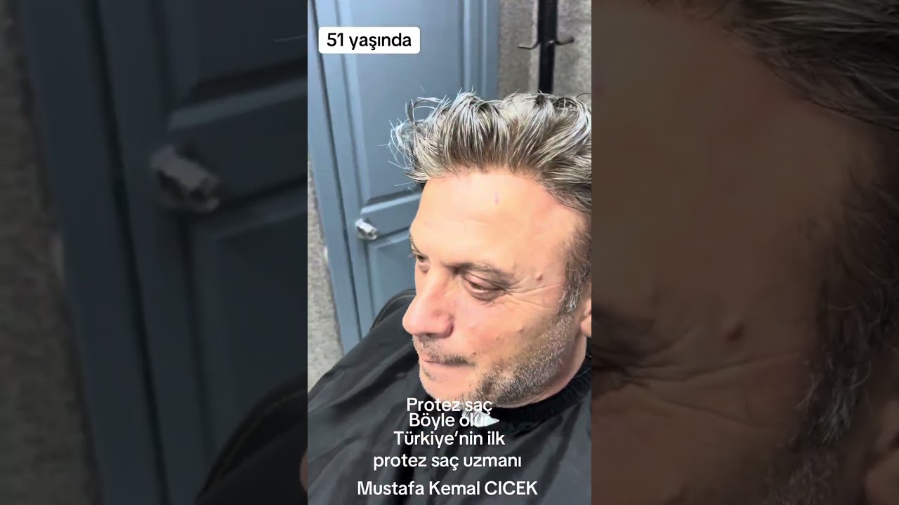 Protez saç