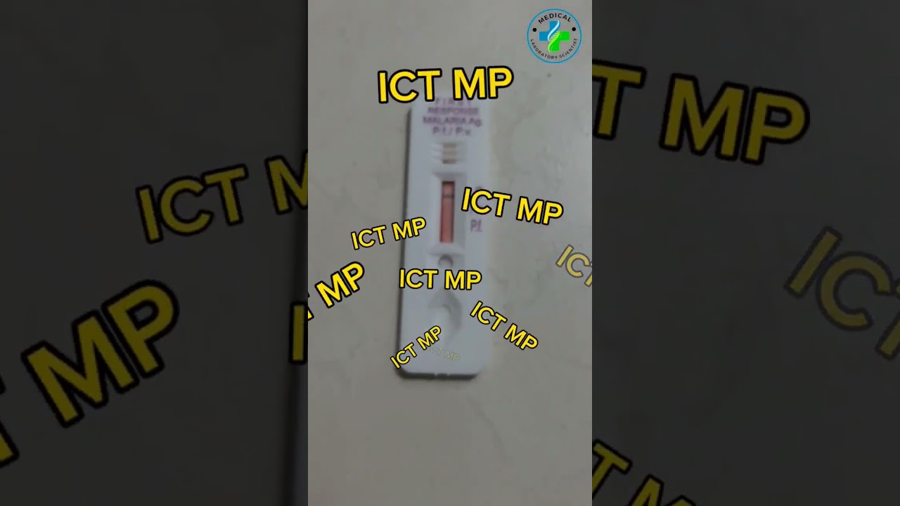 Malaria test | ICT Mp | plasmodium #medicallaboratory #bloodtest #medicallab