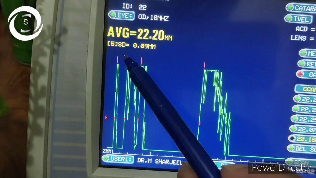 How to perform biometry