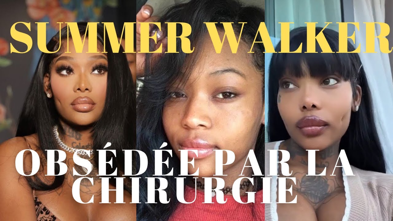 SUMMER WALKER : QUI EST-ELLE ? OBESÉDÉE PAR LA CHIRURGIE ? ÉVOLUTION CHOC. Je te dis tout !