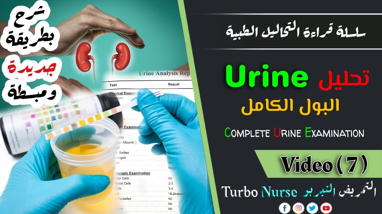 قراءة تحليل البول الكامل بالتفصيل بشرح بسيط Urine analysis