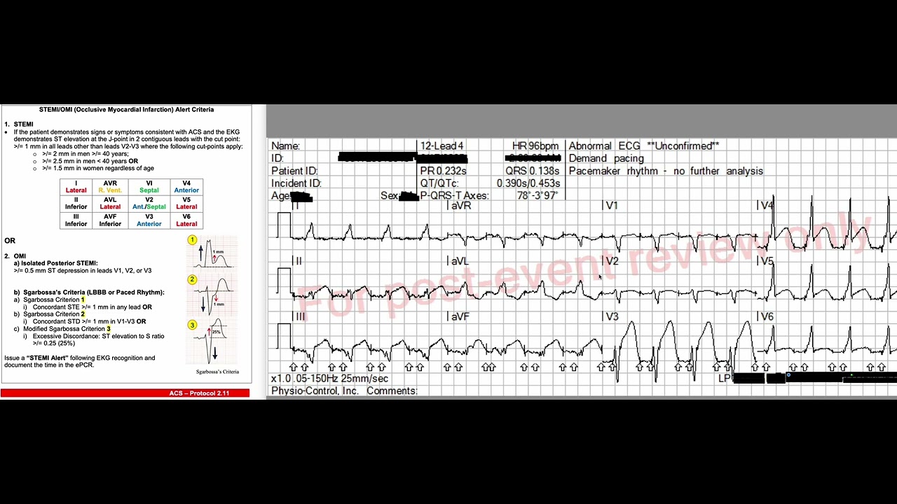 EKG06212025
