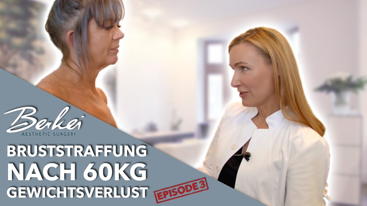 Bruststraffung nach 60kg 😱 Gewichtsverlust Susannes Transformation Episode 3/8