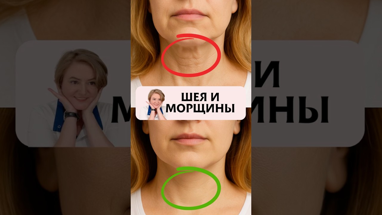 Тяжи на шее  