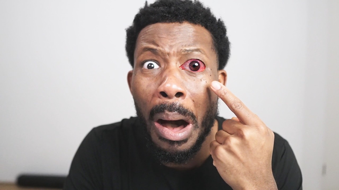 PINK EYE!..oh no