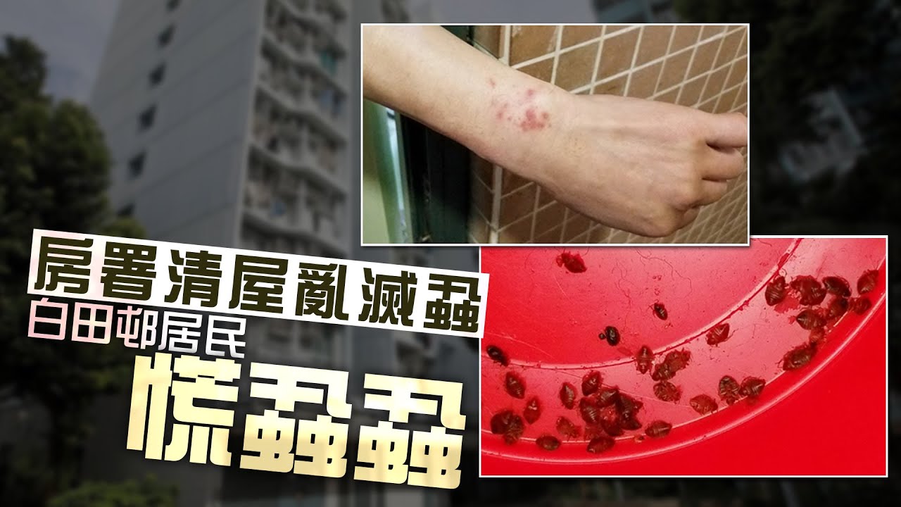 【on.cc東網】房署亂滅蝨害慘白田邨　萬千木蝨大擴散